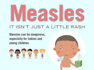 measles